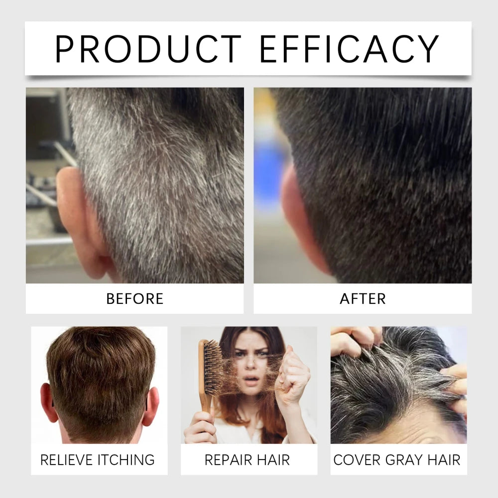Anti-Gray Hair Serum